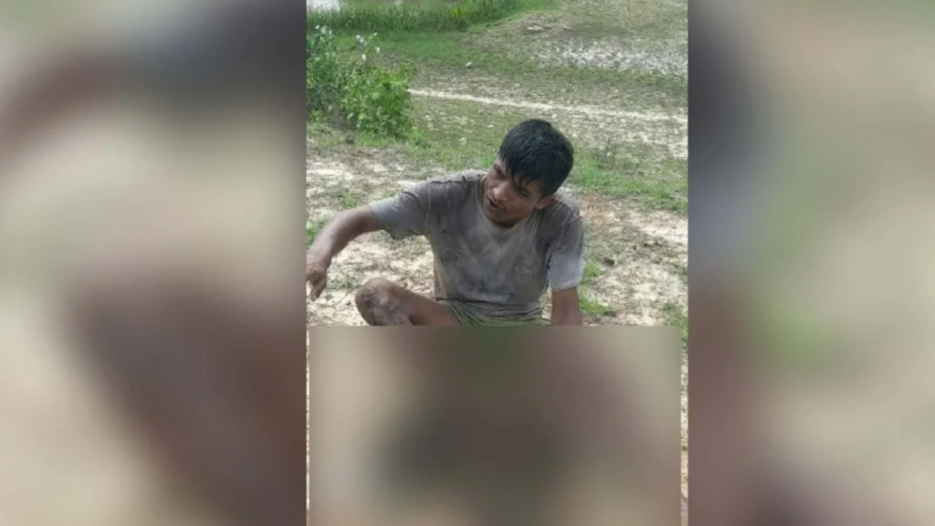 মিয়ানমার সীমান্তে মাইন বিস্ফোরণ, যুবকের পা বিচ্ছিন্ন