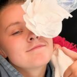 JoJo Siwa Reveals Eye Infection and Concussion After Golf Cart Fall: “I’m a Mess, But I’ll Be Okay”