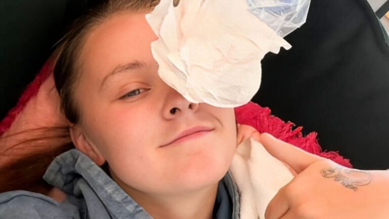JoJo Siwa Reveals Eye Infection and Concussion After Golf Cart Fall: “I’m a Mess, But I’ll Be Okay”